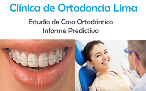 ortodoncia-lima-2